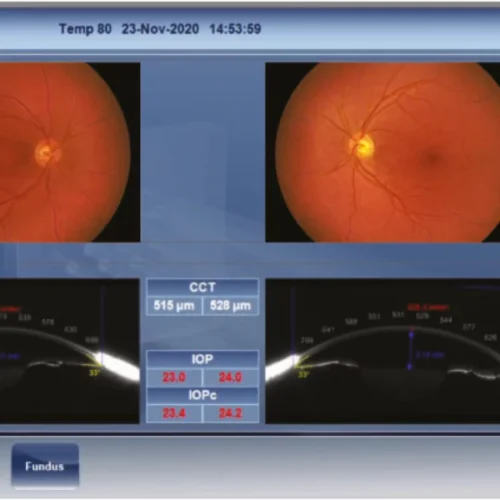 Color Fundus Machine