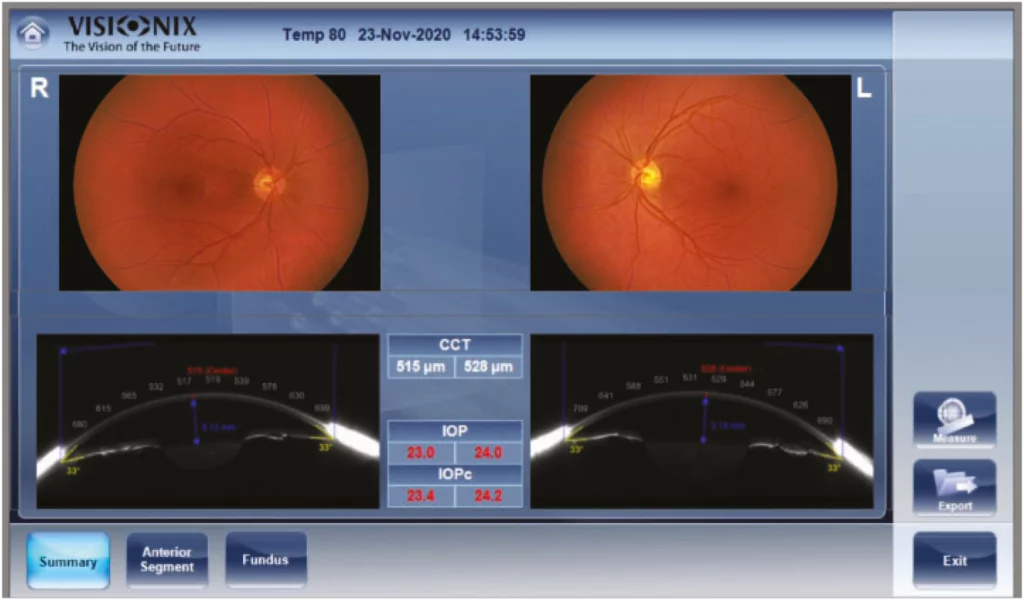 Color Fundus Machine